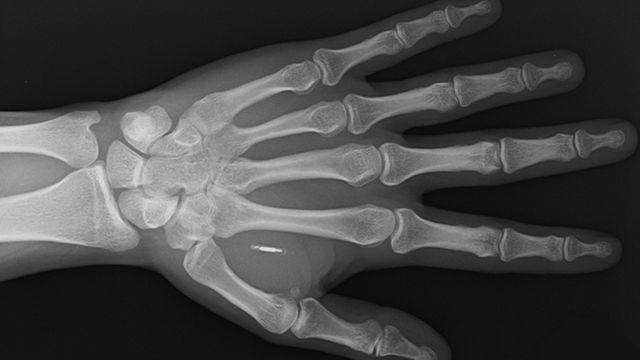 Biohacking